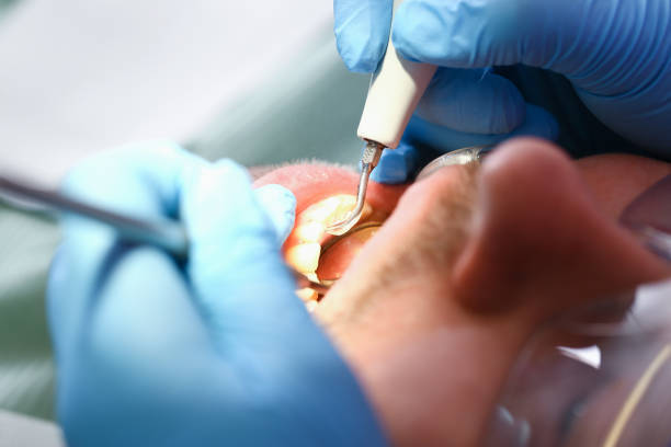 Best Emergency Tooth Extraction in Crow Agency, MT