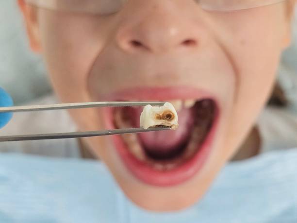 Professional Emergency Dentist in MT