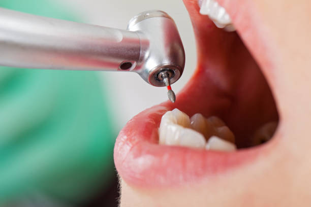 Best Emergency Root Canal Treatment in Crow Agency, MT